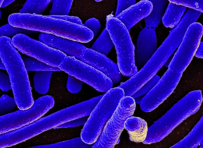 E. coli most often causes the development of cystitis in women